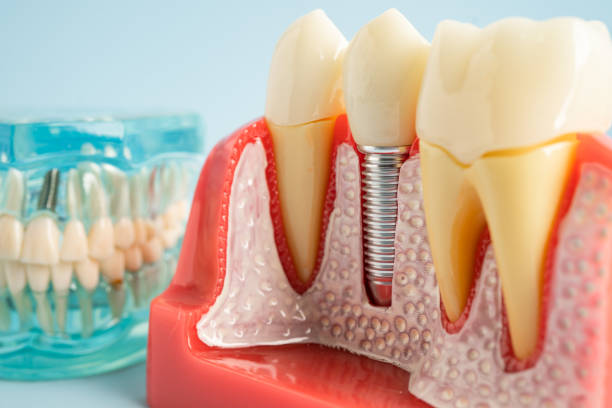 Our Range of Dental Services in Kenai, AK